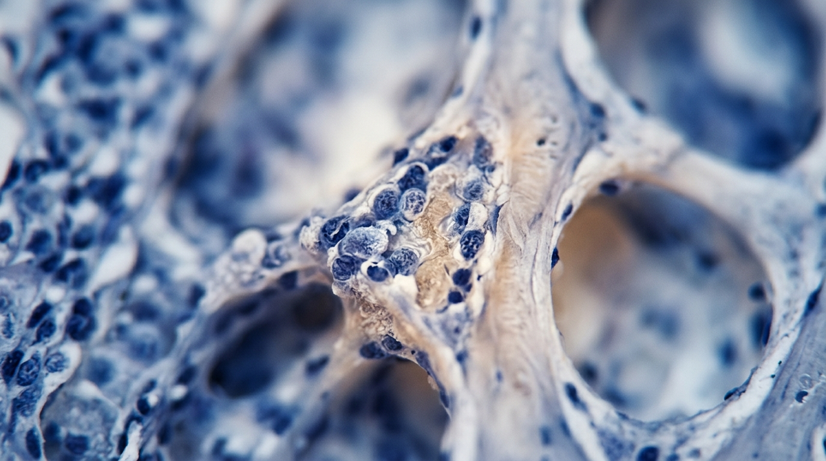Improving Bone Density with Targeted Peptide Therapy